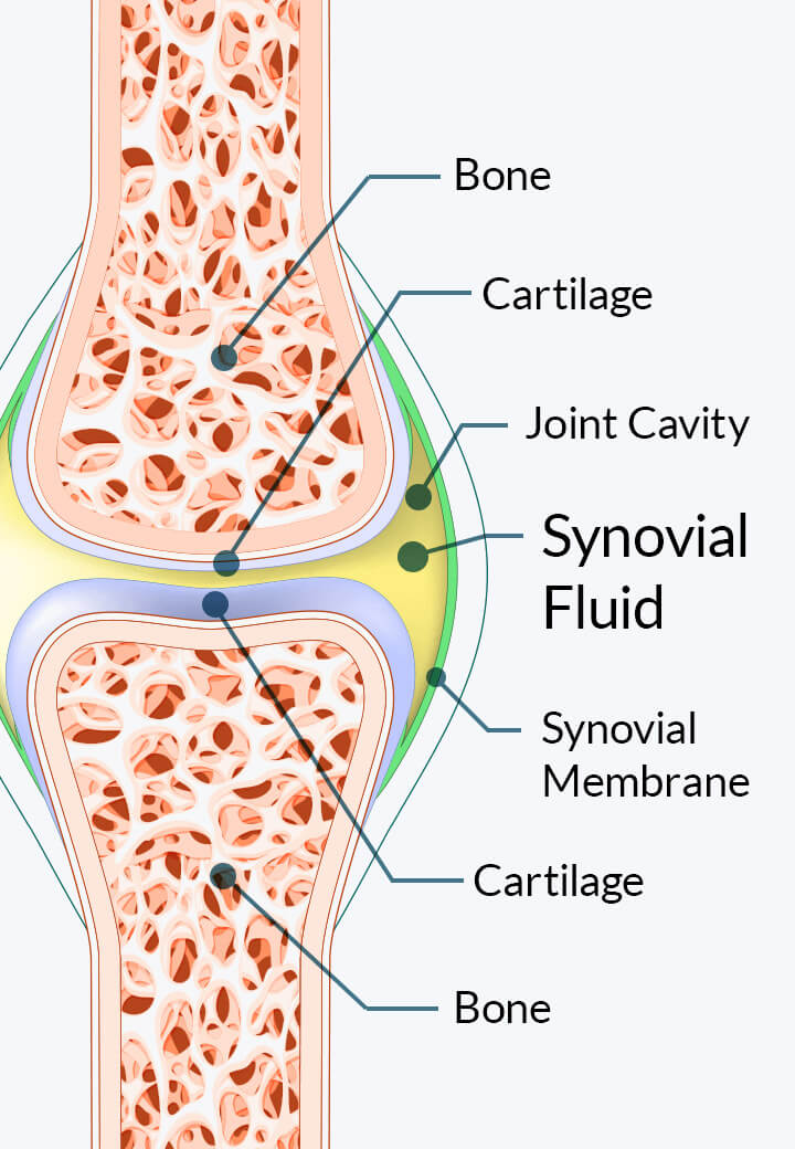 Anatomical diagram of a joint showing bone, cartilage, joint cavity, synovial fluid and synovial membrane